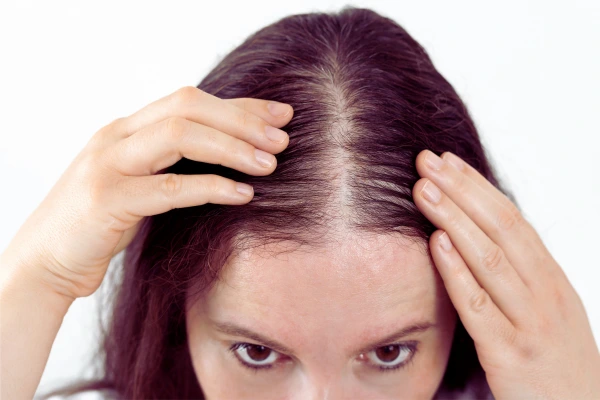 جلوگیری از ریزش مو