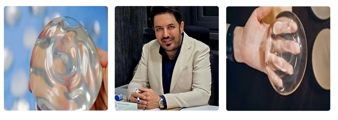 دکتر احسان بیگی متخصص پروتز سینه و باسن