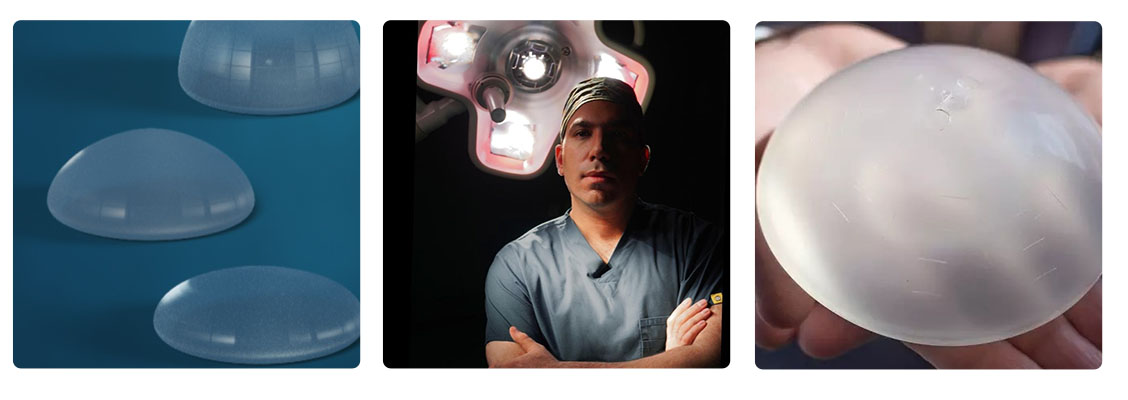 دکتر دلشاد متخصص پروتز سینه و باسن