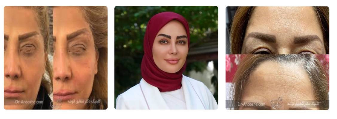 کلینیک زیبایی انوشه