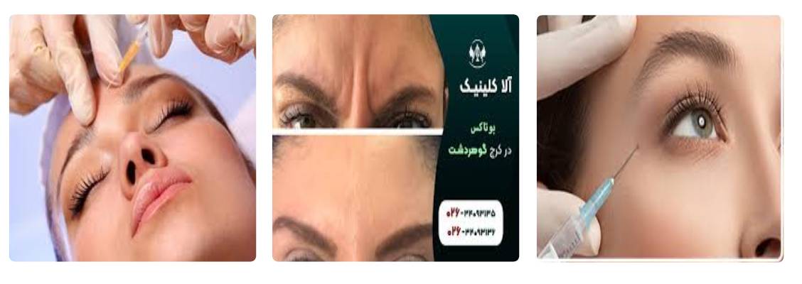 کلینیک زیبایی آلا بهترین مرکز بوتاکس در کرج