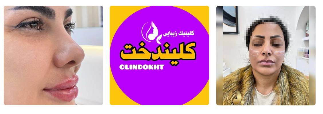 کلینیک زیبایی کلیندخت بهترین مرکز بوتاکس در کرج