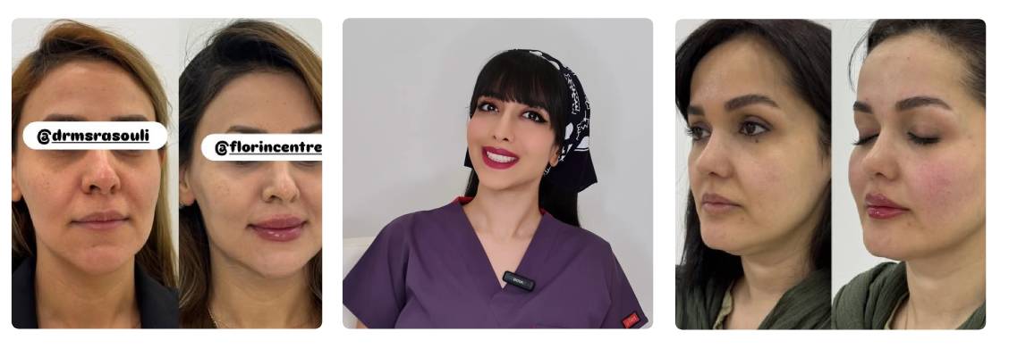 کلینیک زیبایی فلورین بهترین مرکز بوتاکس در کرج