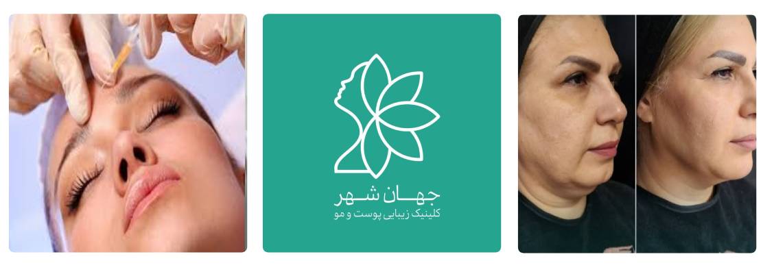 کلینیک زیبایی جهانشهر بهترین مرکز بوتاکس در کرج