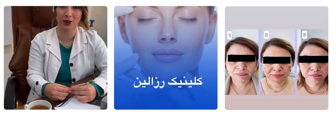 کلینیک زیبایی رزالین